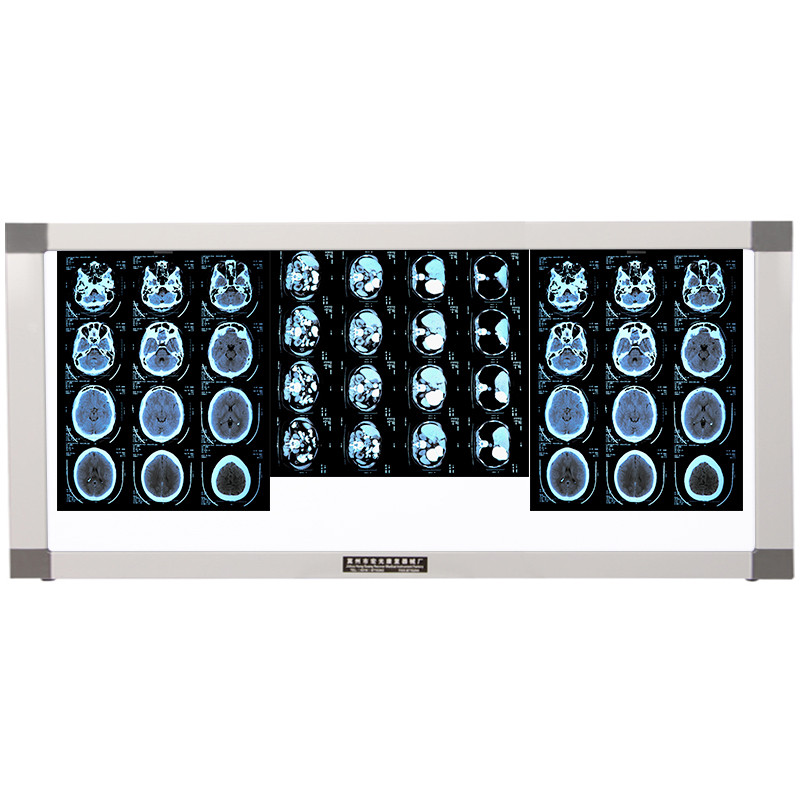 高博士 医用led观片灯箱骨科x光观片灯看片灯阅片灯 三联led厚度10cm