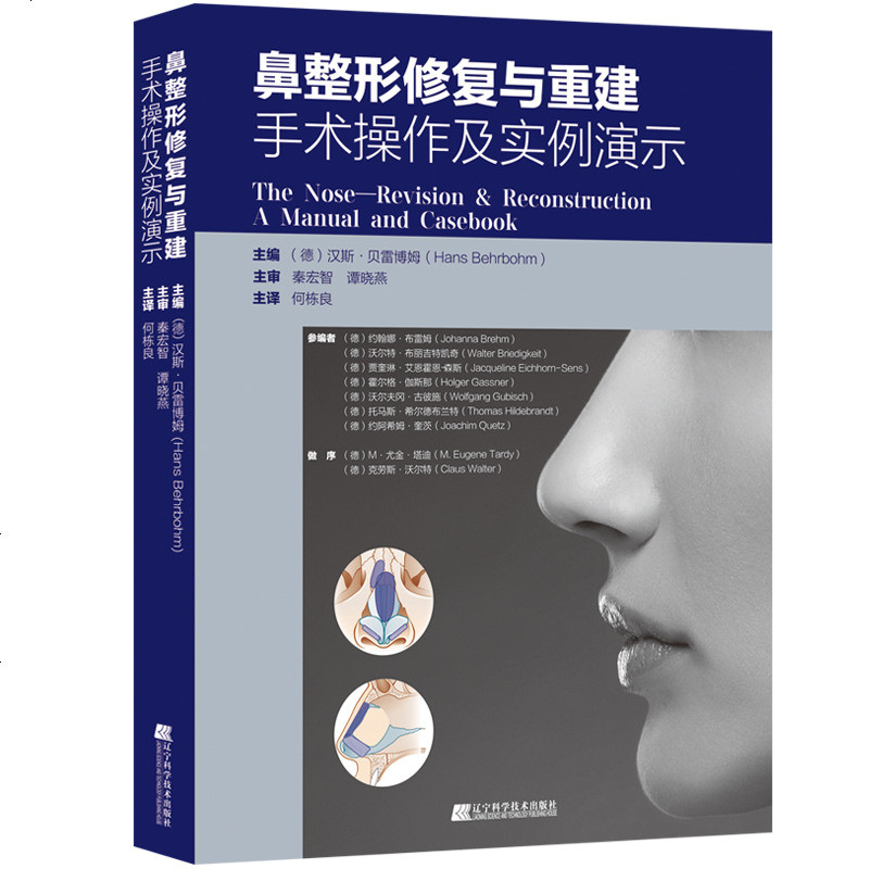 鼻整形修复与重建手术操作及实例演示 何栋良主编 辽宁科学技术出版社