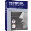 鼻整形修复与重建手术操作及实例演示 何栋良主编 辽宁科学技术出版社